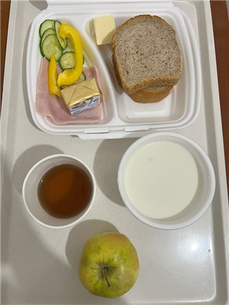 Zdjęcia posiłków, Szpital Wolica w Kaliszu