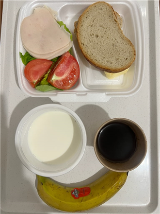 Zdjęcia posiłk&oacute;w, Szpital Wolica