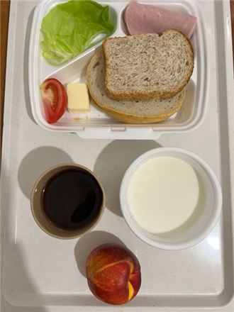 Zdjęcia posiłk&oacute;w, Szpital Wolica