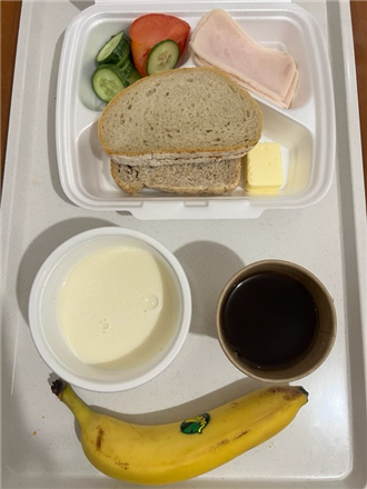 Zdjęcia posiłk&oacute;w, Szpital Wolica