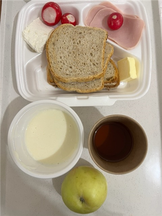 Zdjęcia posiłk&oacute;w, Szpital Wolica