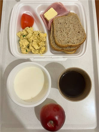 Zdjęcia posiłk&oacute;w, Szpital Wolica