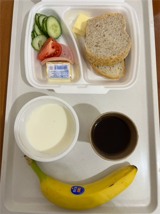 Zdjęcia posiłk&oacute;w, Szpital Wolica