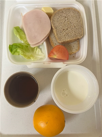 Zdjęcia posiłk&oacute;w, Szpital Wolica