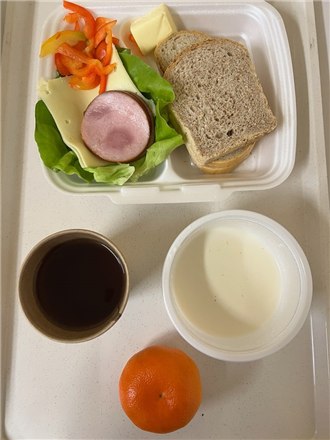 Zdjęcia posiłk&oacute;w, Szpital Wolica