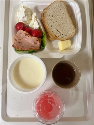 Zdjęcia posiłk&oacute;w, Szpital Wolica