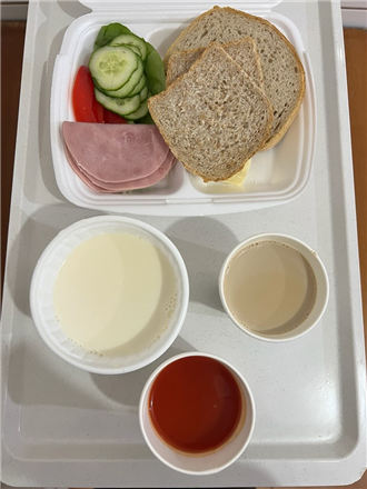 Zdjęcia posiłków, Szpital Wolica